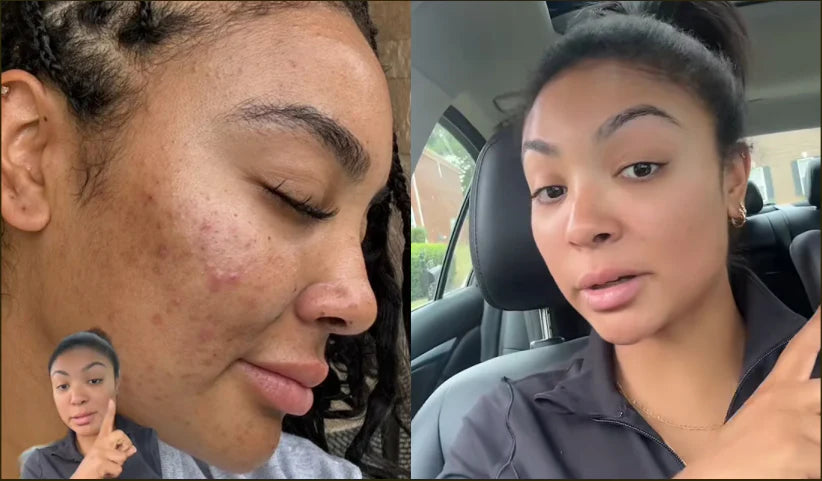 Antes y Después Mónica