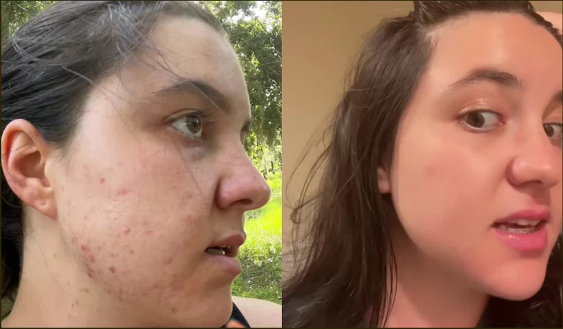 Antes y Después Tania